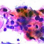 Δοκιμασία οξικού οξέως